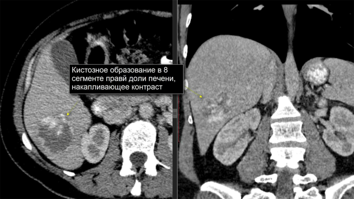 ᐈ КТ печени Цены от 3200 рублей 11 адресов на KTdiagnostik