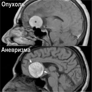 Фото Опухоль мозга, более 88 качественных бесплатных стоковых фото