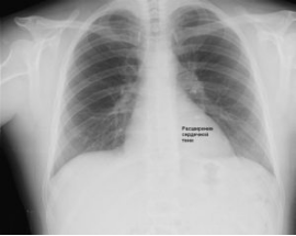 Как правильно называется исследование легких при помощи рентгена